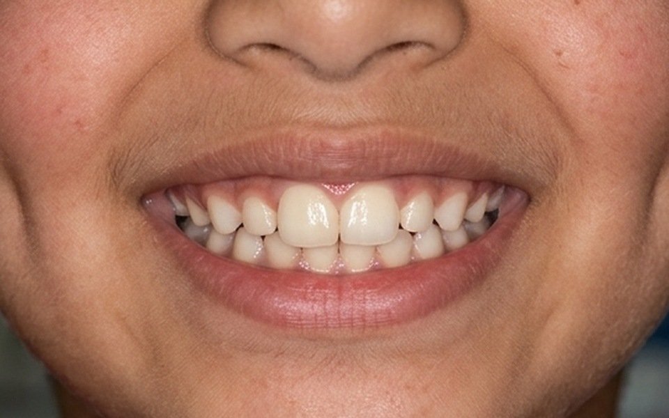 Dentistry for Children at Tuskers Dental